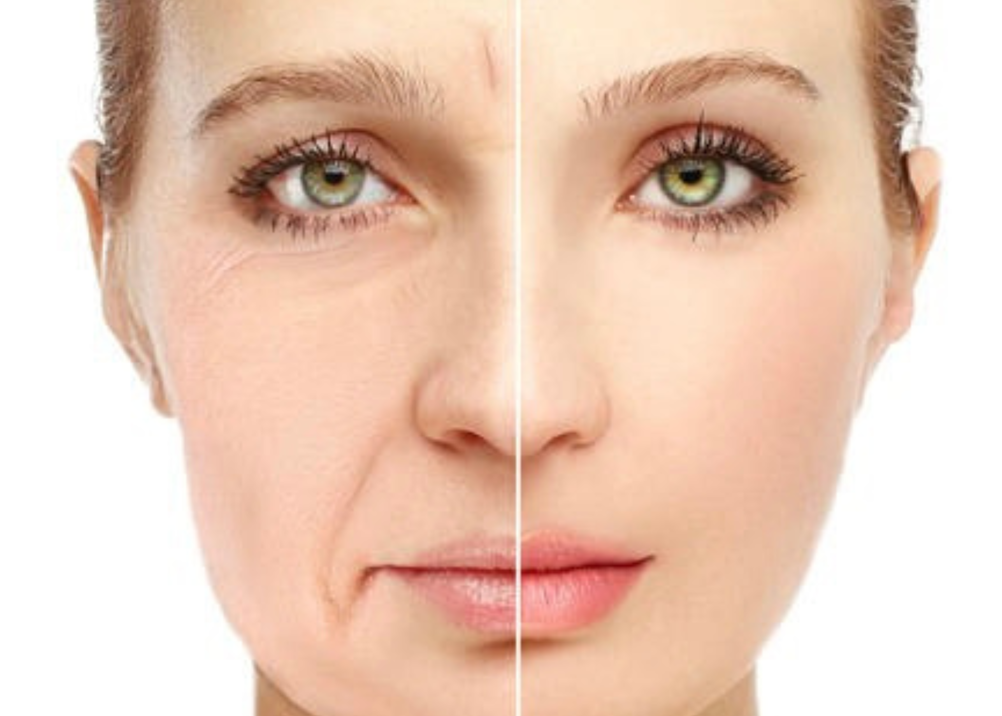 Trẻ hóa da công nghệ DPL